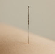Acupuntura activa